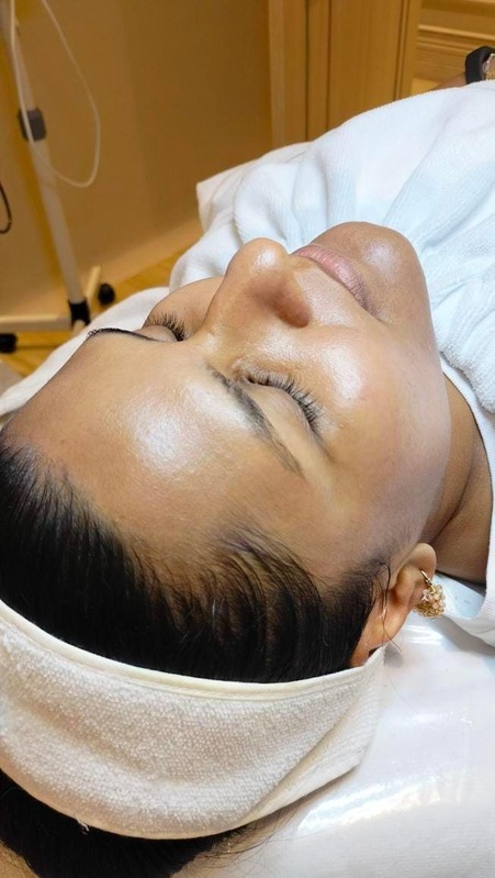 Después hidratación facial
