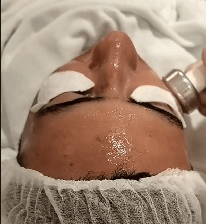 Dermofacial