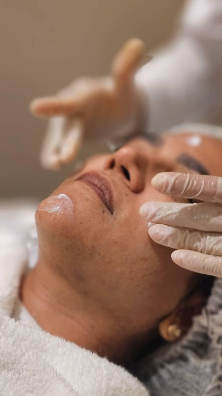 Tratamiento Peeling